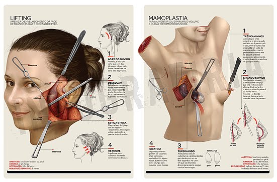 PRE-OPERATORIO CIRUGIA ESTETICA